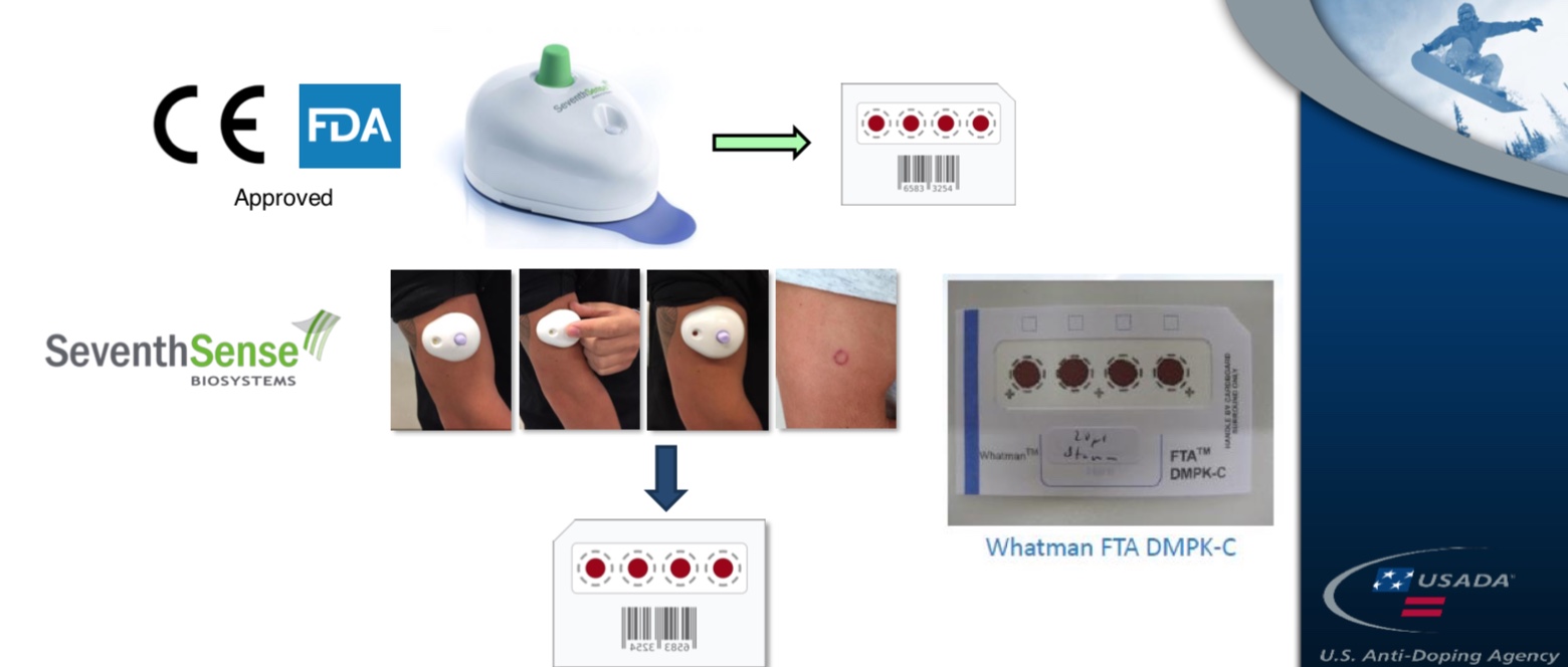 A Possible New Anti-Doping Tool: Dried-Blood-Spot Testing